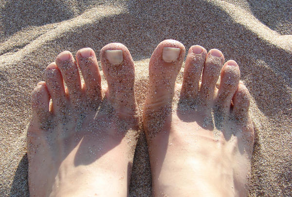Reasons To Know Why Your Feet Are Peeling