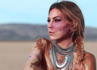 Woman Transforms Her Birthmark Into Beautiful Art