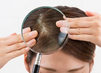 The only Dandruff Cure You’ll Ever Need dry scalp