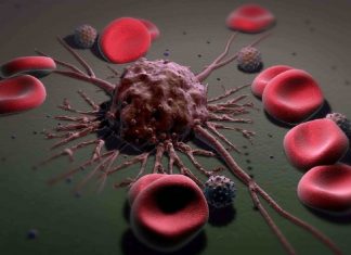Laser Destroys Cancer Cells Circulating in the Blood