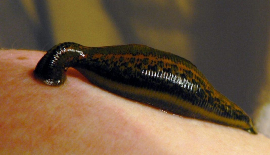 People Are Keeping Parasitic Leeches as Pets, And Letting Them Drink ...