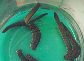 People Are Keeping Parasitic Leeches as Pets, And Letting Them Drink Their Blood