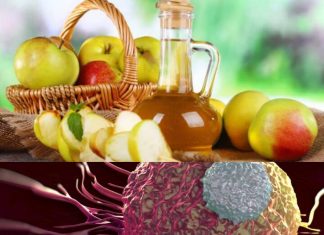 6 Health Benefits of Apple Cider Vinegar, Backed by Science