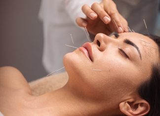 Can Facial Acupuncture Ease Fine Lines & Wrinkles? Here’s The 101